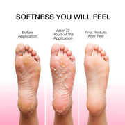 DEDOX Glycolic Acid Foot Peel Mask – Exfoliating Dead Skin Remover for Cracked Heels & Callus Repair | Vitamin E, Niacinamide B3 & Sodium Hyaluronate | Korean Foot Care Treatment 50ml