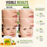 DEDOX Kojic Acid & Turmeric Cleansing Pads – Exfoliating Face Toner Pads for Glowing Skin, Acne, Dark Spots & Pigmentation (60 Pads) | Korean Skincare